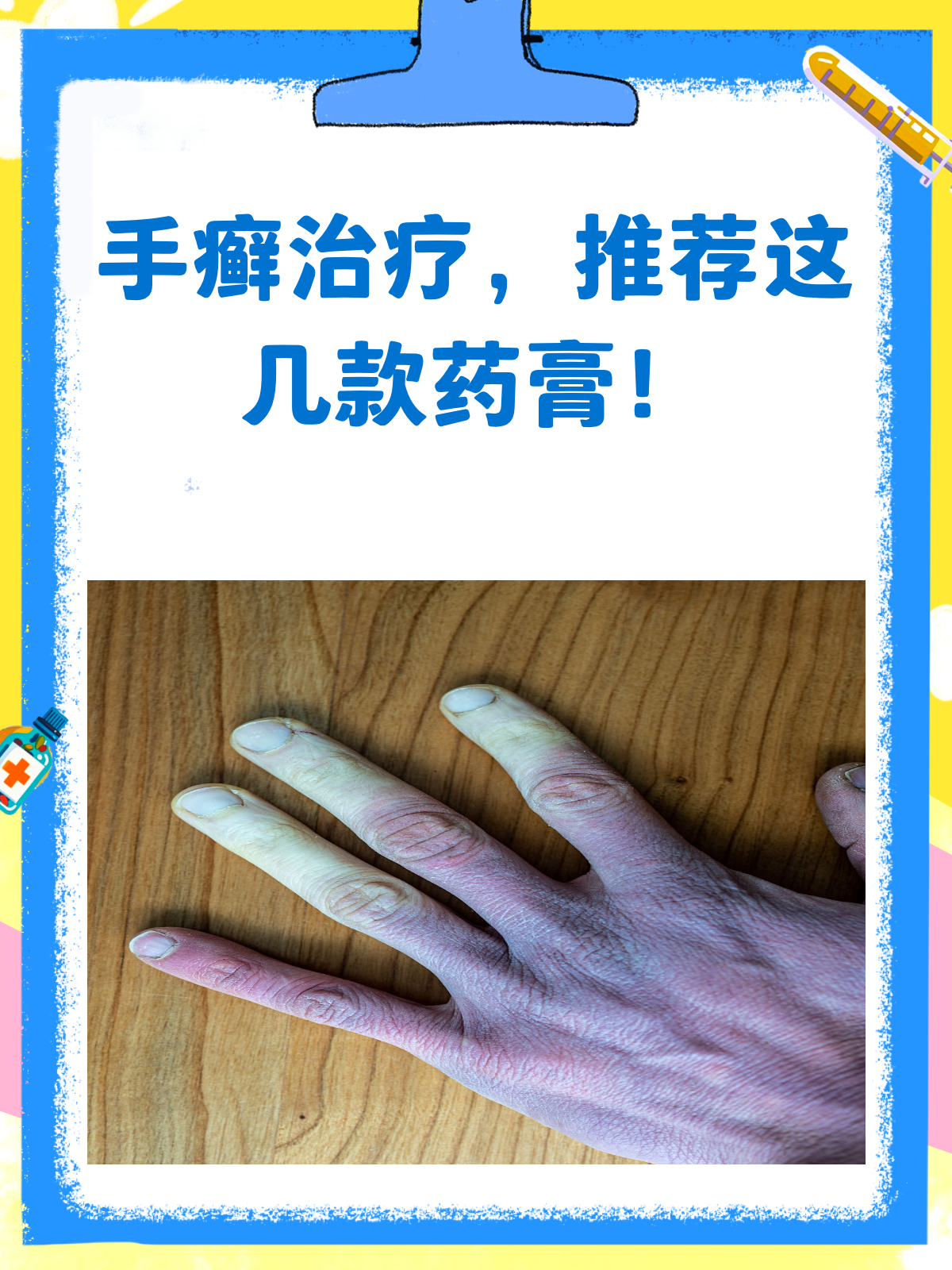 手癣来袭?选对药膏很关键!