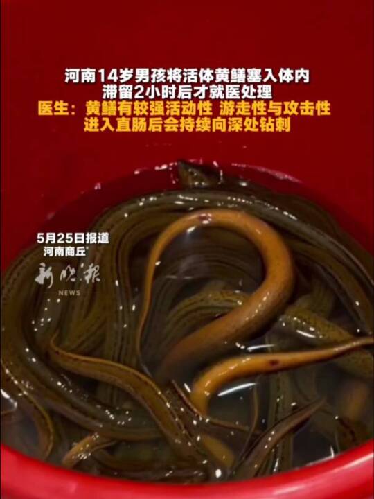 河南14岁男孩将活体黄鳝塞入体内，滞留2小时后才就医处理。医生：黄鳝有较强活动性、游走性与