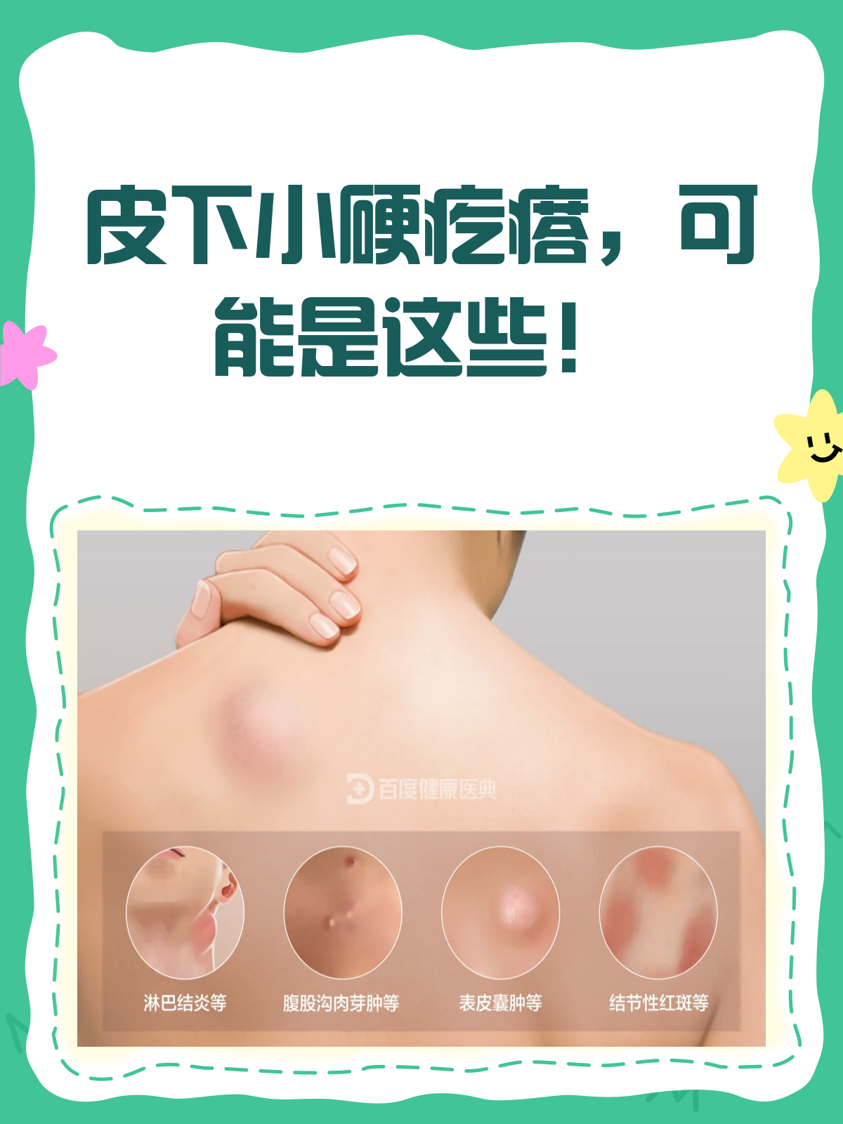 皮下小硬疙瘩？揭秘它的“真身”！