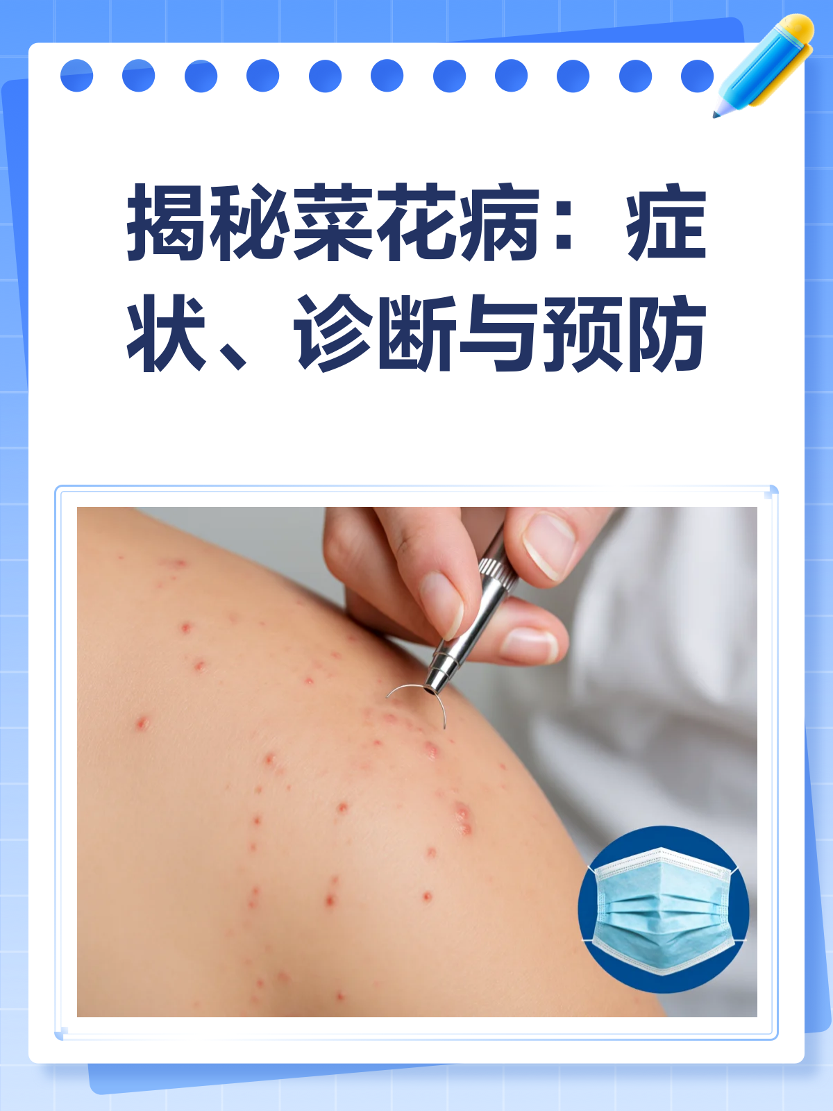 揭秘菜花病：你不可不知的尖锐湿疣知识！