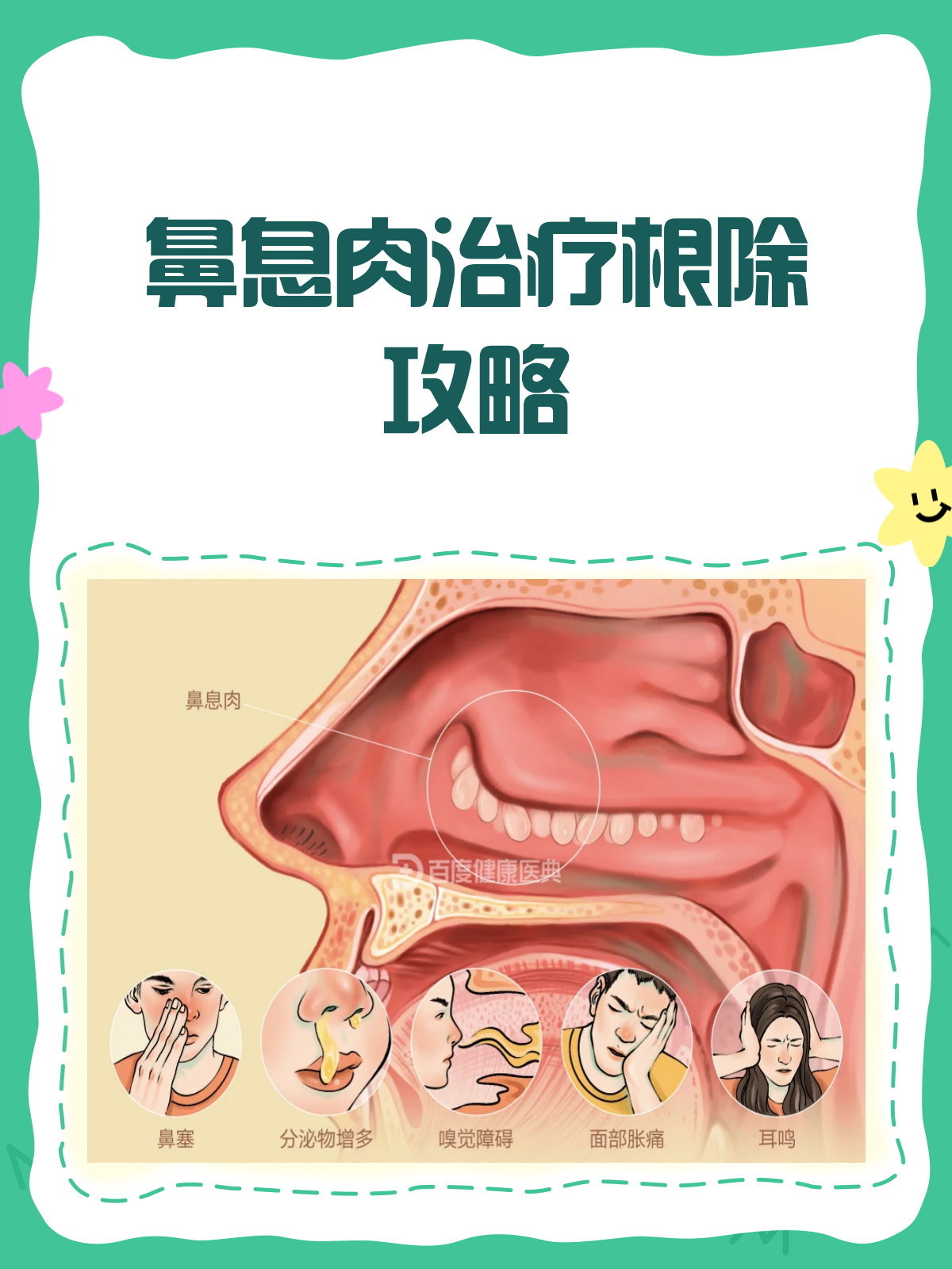 鼻息肉怎么治疗才能不复发?医生告诉你!