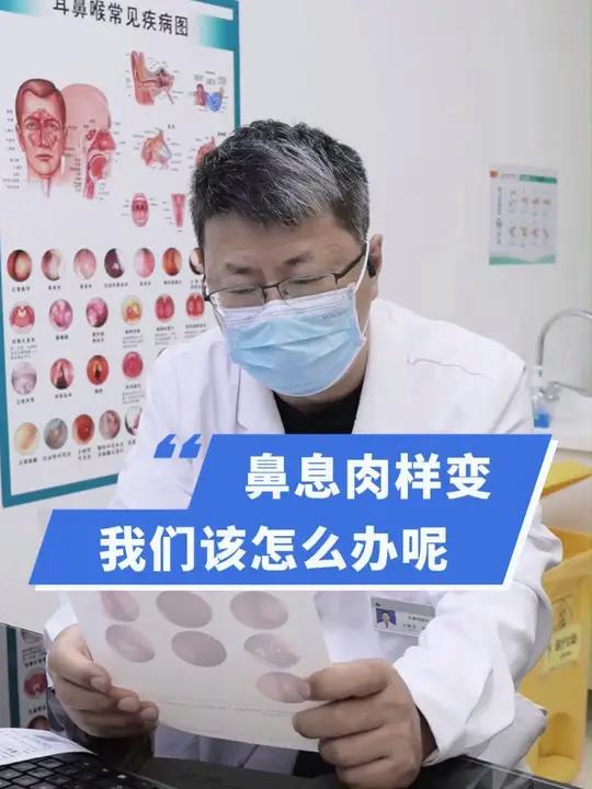 什么是鼻息肉样变?该怎么处理