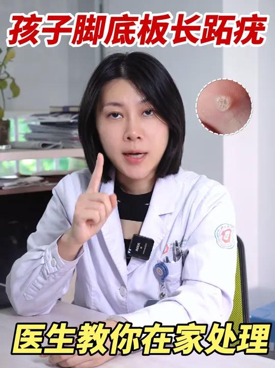 孩子脚底板长硬疙瘩,液氮冷冻怕疼,可以试试在家这样做