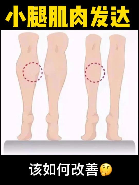 改善小腿肌肉发达