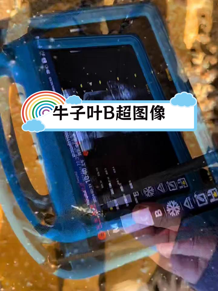 高清B超显示牛子叶纹理与菜花状变化