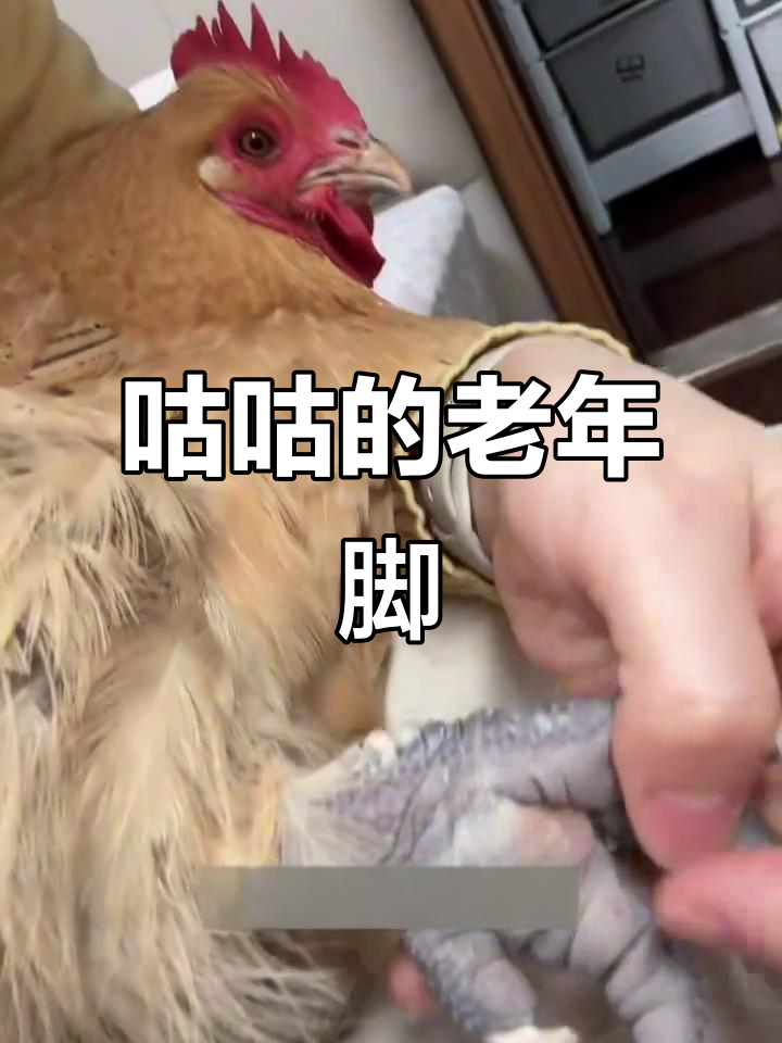 2岁咕咕脚底长鸡眼,手术过程竟然如此忍痛!
