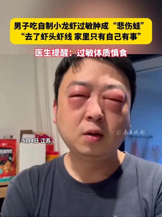 男子吃自制小龙虾过敏肿成“悲伤蛙”“去了虾头虾线 家里只有自己有事” 医生提醒:过敏体质慎