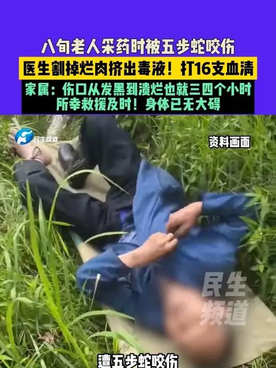 八旬老人采药时被五步蛇咬伤,医生割掉烂肉挤出毒液!打16支血清,家属:伤口从发黑到溃烂也就