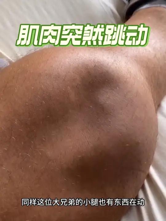 腿上的肌肉不停跳动,其实这就是肌肉痉挛!