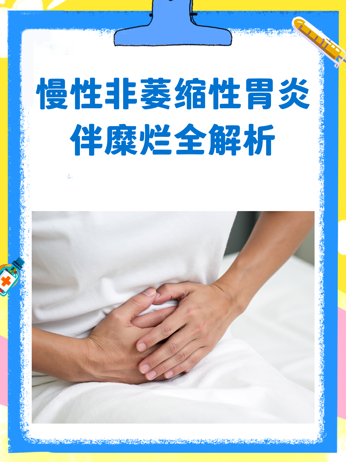 慢性非萎缩性胃炎伴糜烂,一文读懂!