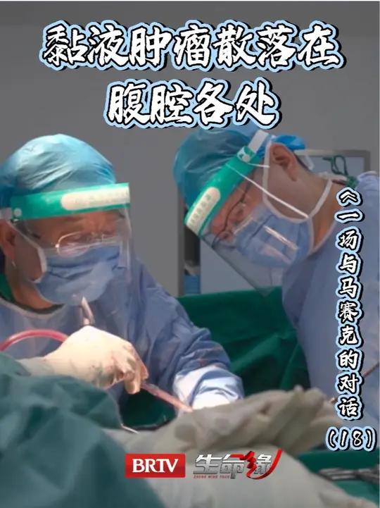 黏液肿瘤散落在腹腔各处,手术的核心任务之一,就是清理这些肿瘤(18)brtv生命缘 北京两