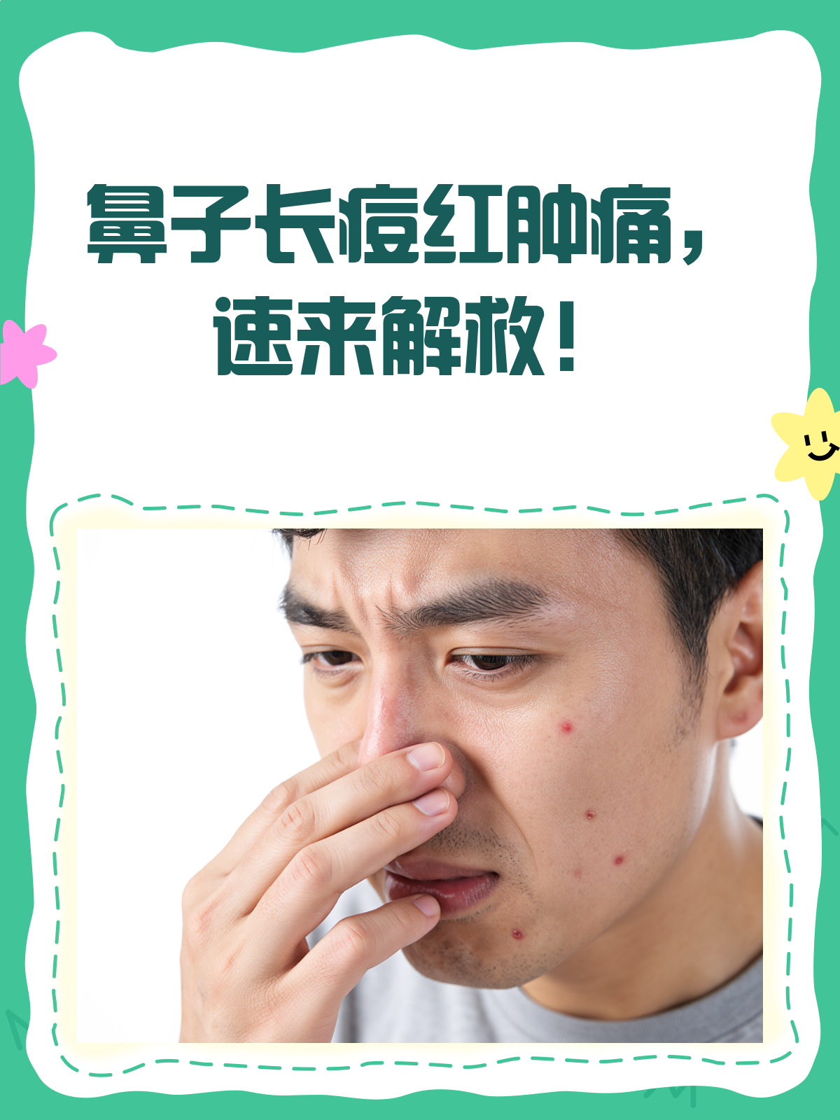 鼻子爆痘红肿痛？揭秘原因与应对大法！