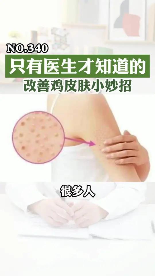 天来了,身上有鸡皮肤怎么办,医生教你一个小妙招,缓解你的