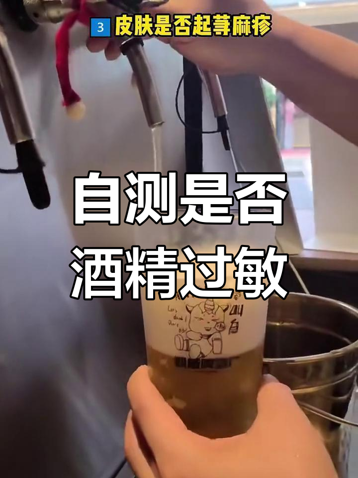 酒精过敏自查方法,快速判断你是否对酒有反应