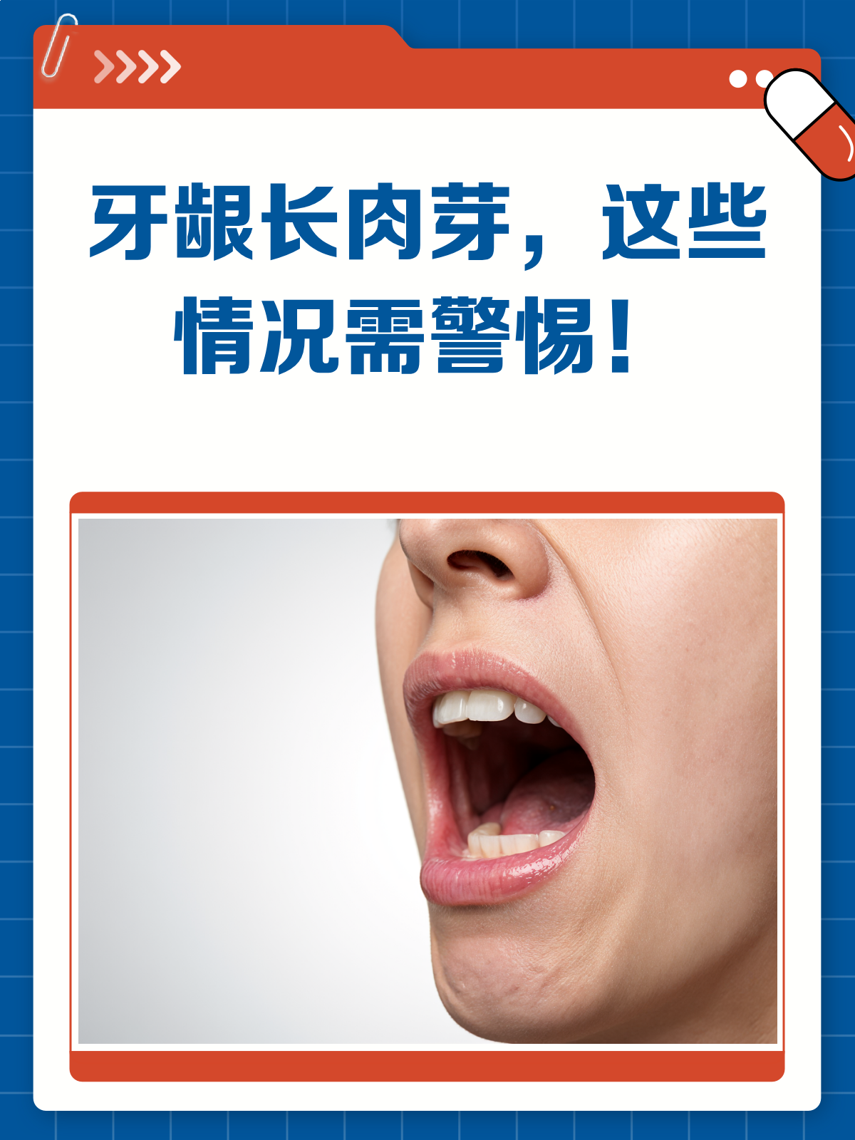 牙龈长肉芽？别急，先看看这篇科普！