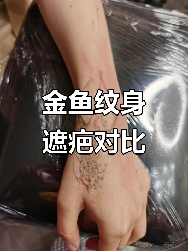 水彩金鱼纹身遮盖疤痕,效果惊艳!