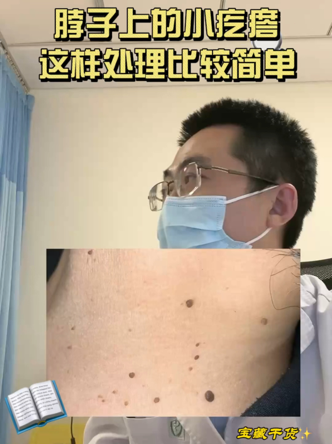 脖子上的小肉疙瘩,这样处理更好