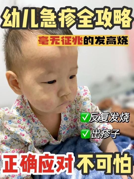 1岁左右宝宝突然反复高烧 警惕幼儿急疹