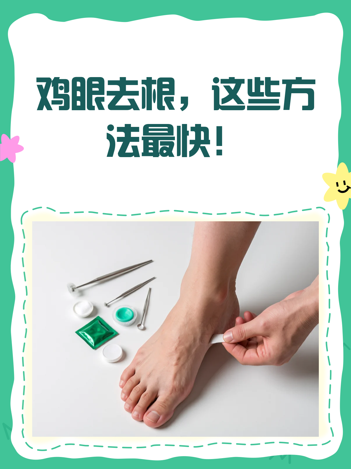 鸡眼去根秘籍,这些方法真的有用!