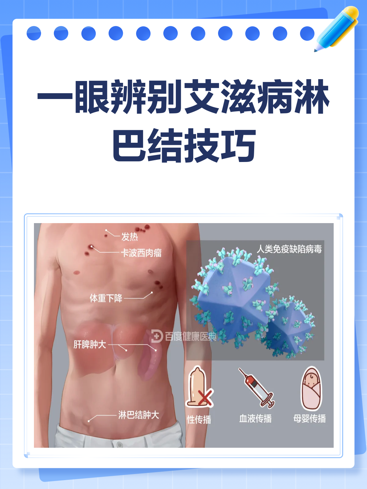 一眼辨别艾滋病淋巴结,这些信号要注意!