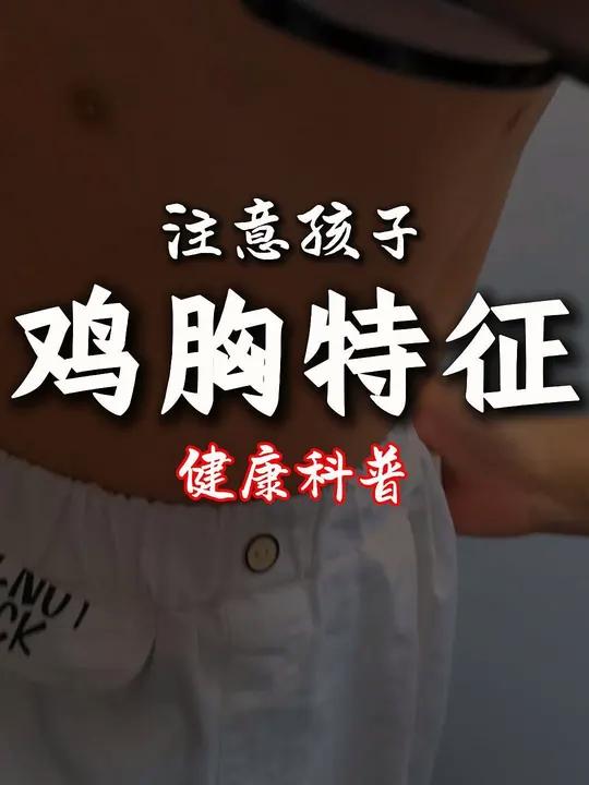 什么是鸡胸?有什么典型的体征?鸡胸硬核健康科普行动儿童健康 胸壁畸形