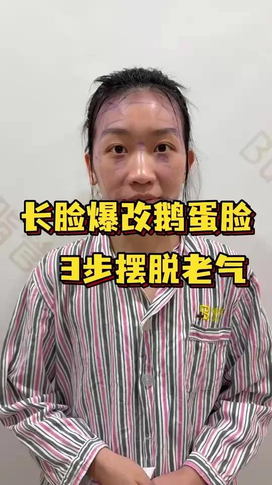 长脸爆改鹅蛋脸,3步摆脱老气
