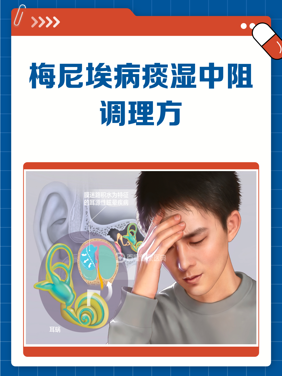 梅尼埃病痰湿中阻?试试半夏白术天麻汤!