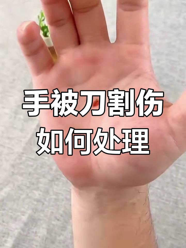 切菜受伤?蛋壳膜敷三天痊愈,刺扎手怎么办