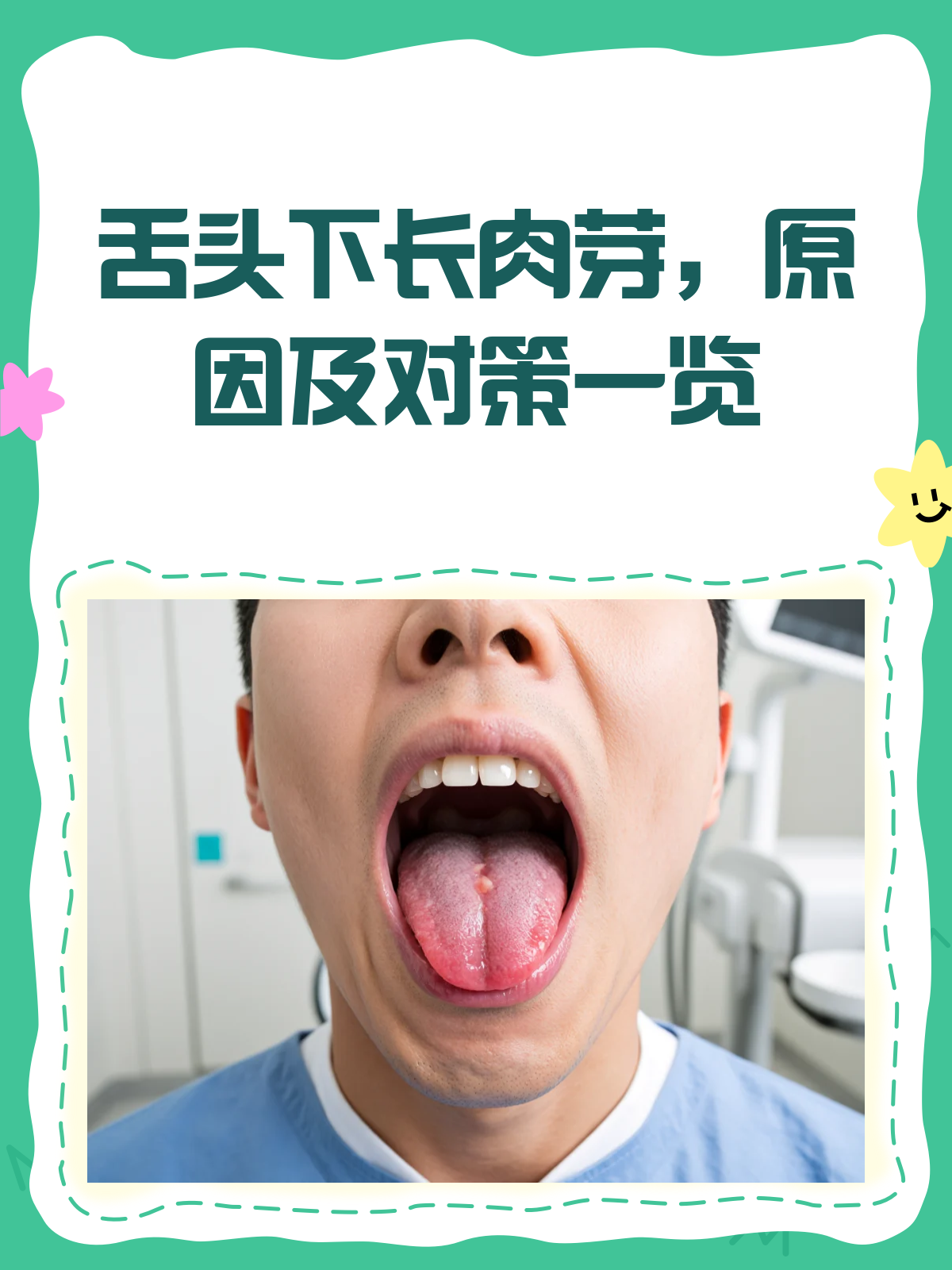 舌头下长小肉芽？别慌，先来看看这个！