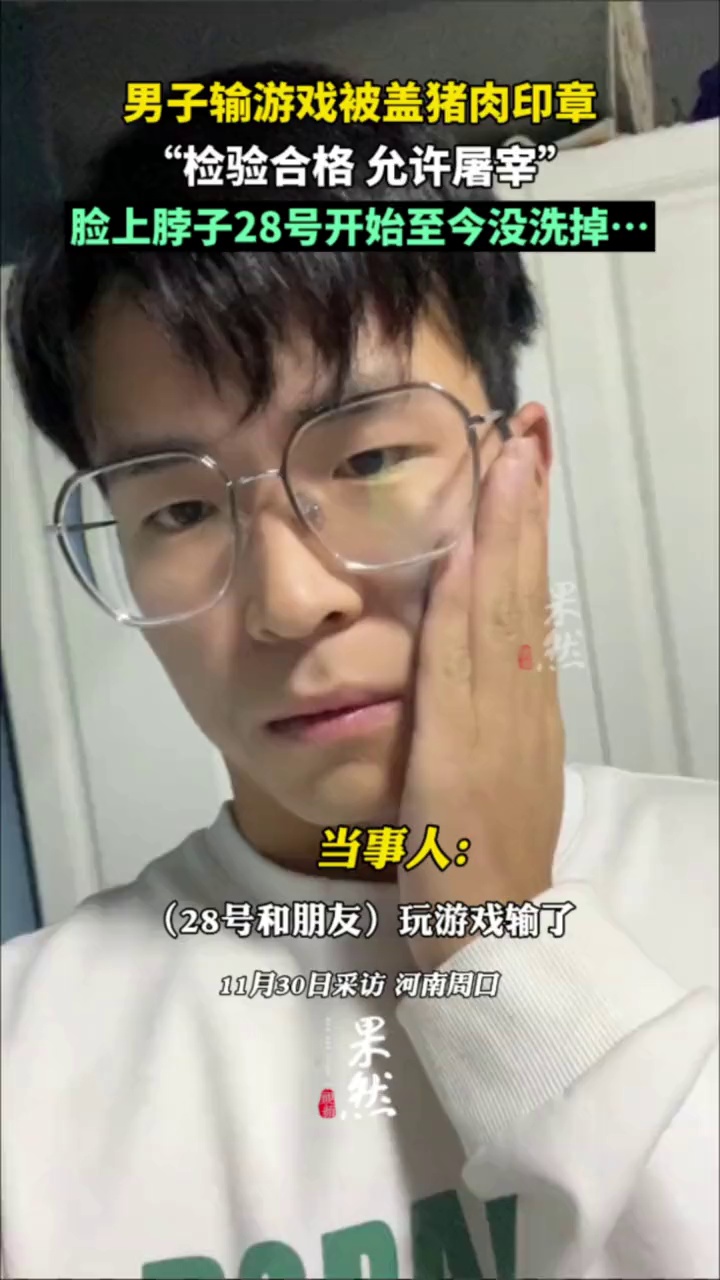 男子输游戏被盖猪肉印章,“检验合格允许屠宰”,脸上脖子28号开始,至今没洗掉……