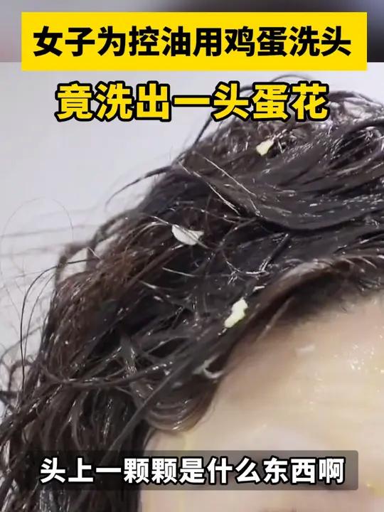 用鸡蛋洗头能让头发柔顺干爽?医生:是可行的,但不建议!