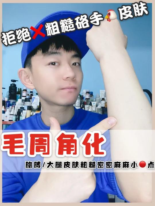 身上密密麻麻粗糙的小红点!如何改善鸡皮肤?