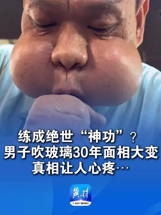男子吹玻璃30年吹成“青蛙王子”,真相却是面部肌肉拉伤变形,师傅还幽默自嘲会“蛤蟆功”网友