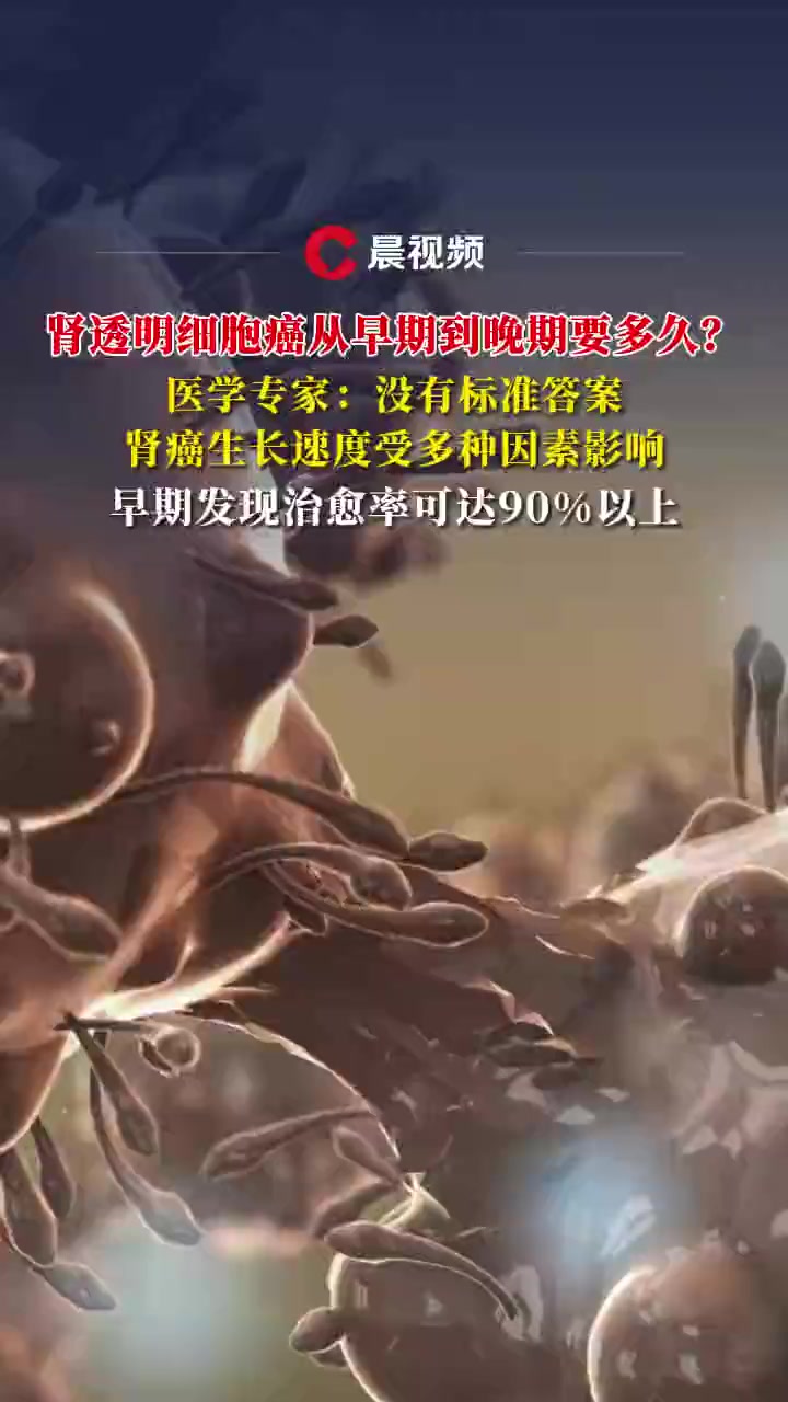 肾透明细胞癌从早期到晚期要多久?专家:受多种因素影响,早期治愈率可达90%以上