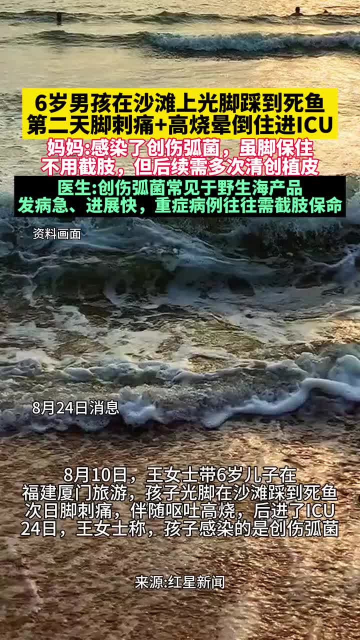 「视频」6岁男孩沙滩上光脚踩到死鱼,第二天脚刺痛高烧晕倒住进ICU