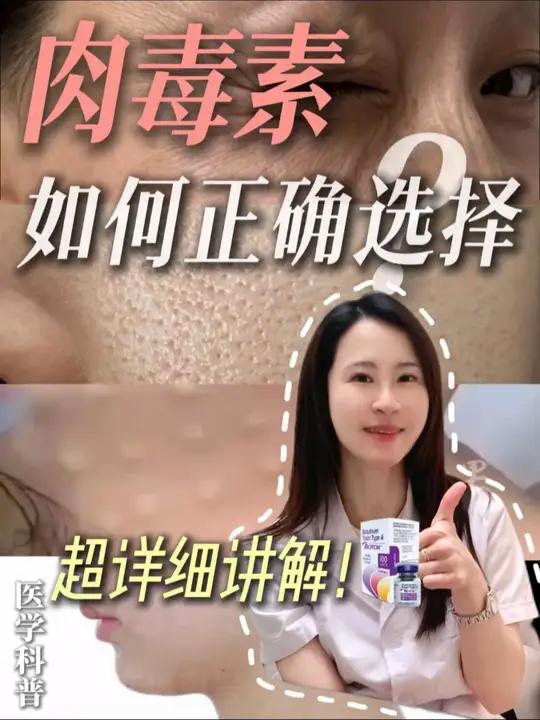 肉毒素到底有多好,怎么正确选择肉毒素?#肉毒素 #保妥适 #衡力 #医学科普 #陈若思