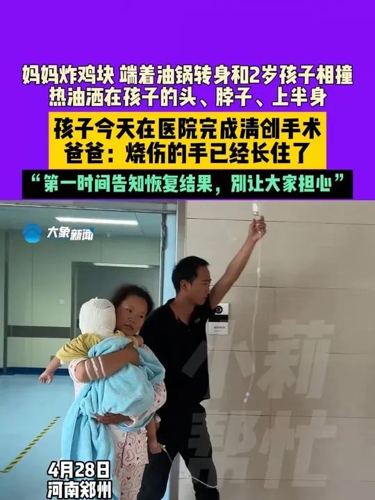 4月28日河南郑州,4月28日河南郑州,妈妈炸鸡块 端着油锅转身撞到2岁孩子,热油洒在孩子
