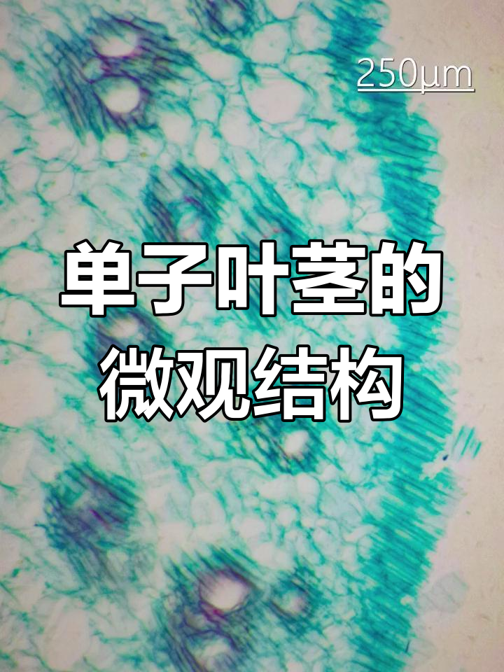 显微镜下的单子叶植物茎横切