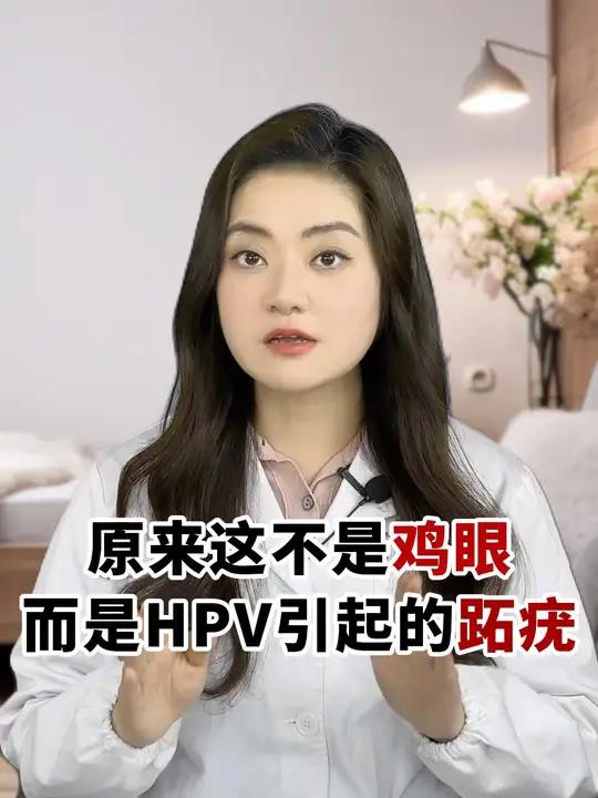 这可能不是鸡眼,而是跖疣!