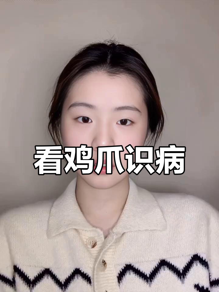 鸡爪异常识别与疾病应对技巧