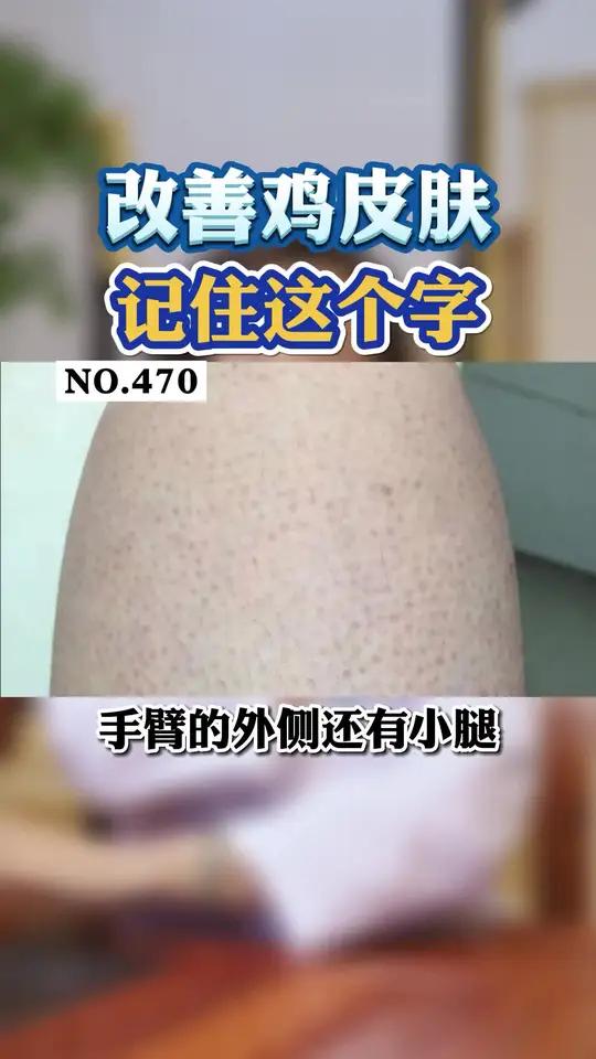 手臂、小腿皮肤像鸡皮一样,不敢穿短袖短裤,想要改善记住这个字
