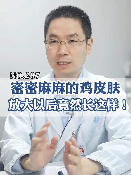 鸡皮肤放大以后的样子你见过吗?竟然是根毛!鸡皮肤 毛周角化