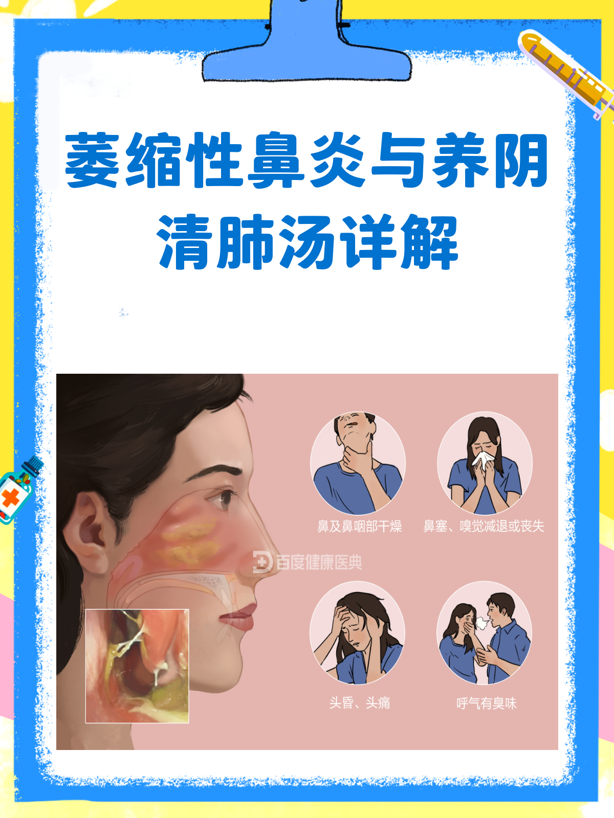 萎缩性鼻炎不用慌,养阴清肺汤来帮忙