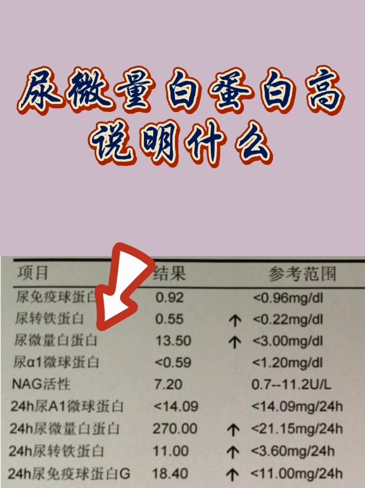尿微量白蛋白高说明什么