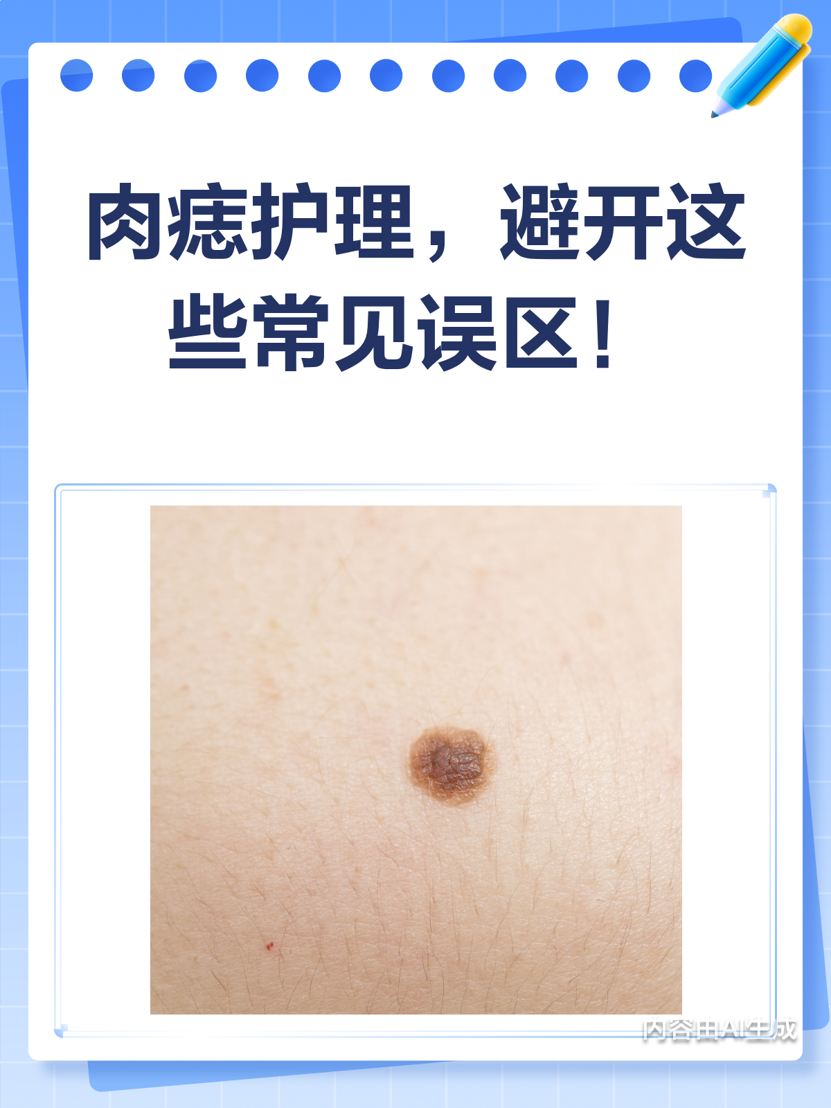肉痣护理,这些误区你中招了吗?
