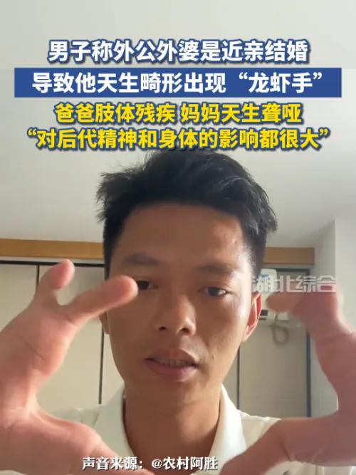 男子称外公外婆是近亲结婚,导致他天生畸形出现“龙虾手”