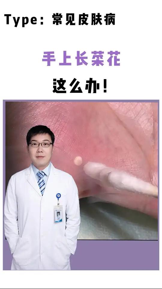 手上长一颗颗像菜花一样,到底是啥?怎么办