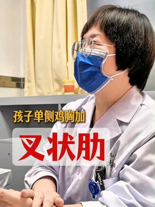孩子单侧鸡胸加叉状肋