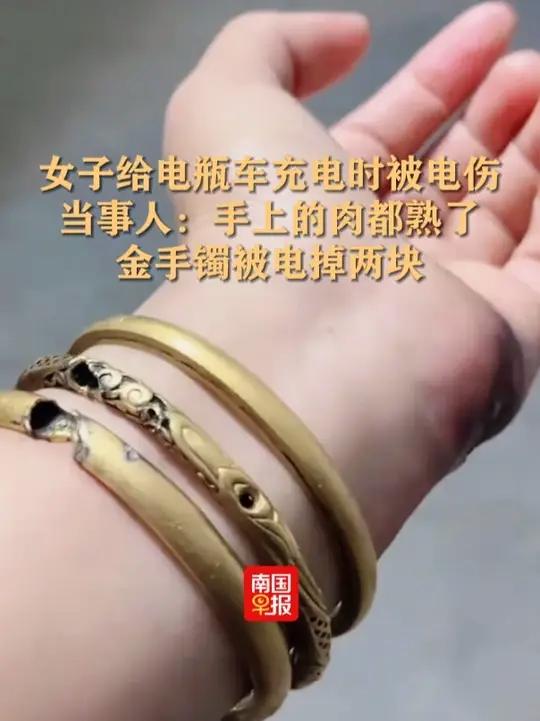 女子给电瓶车充电时被电伤,当事人:手上的肉都熟了,金手镯被电掉两块