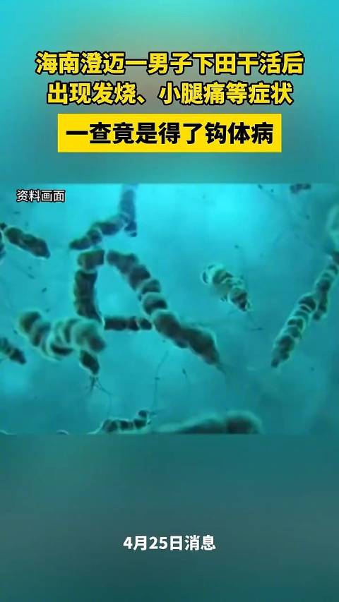 「男子雨天蹚水后住进ICU!医生:感染致死率高达70%!」男子雨天蹚水后出现发烧、头痛、小